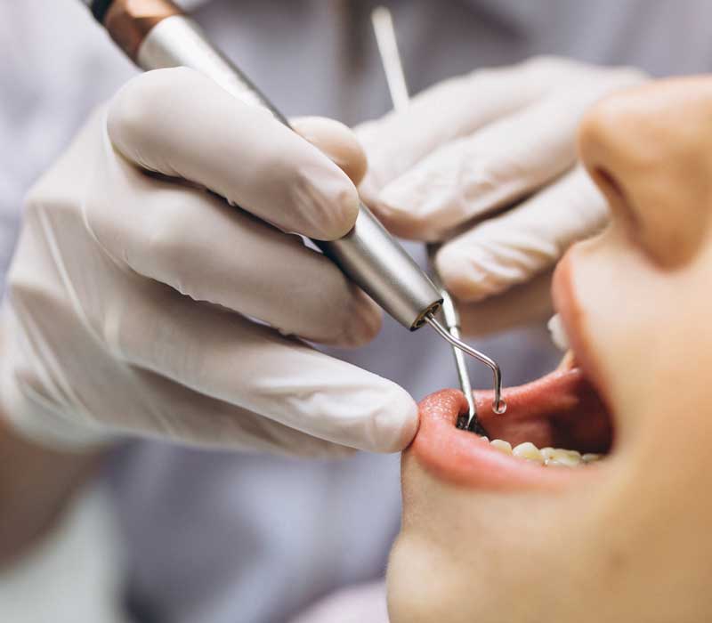 dental3