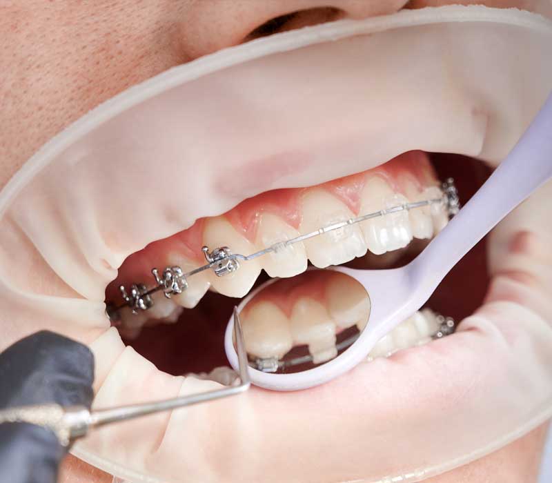 dental4