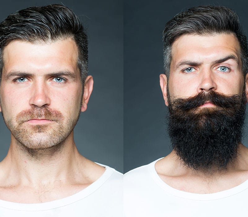 beard1