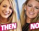 Blake Lively: Eyelid and Nose Job Surgery