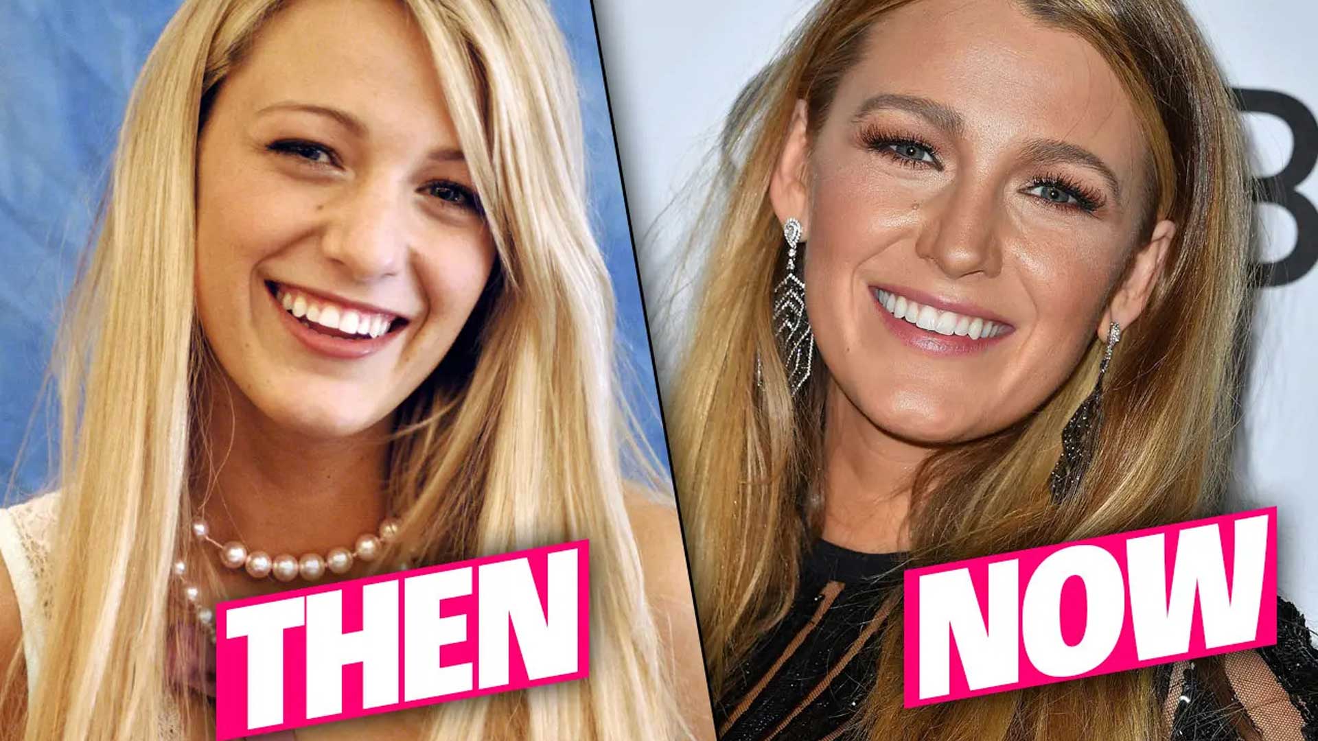 Blake Lively: Eyelid and Nose Job Surgery