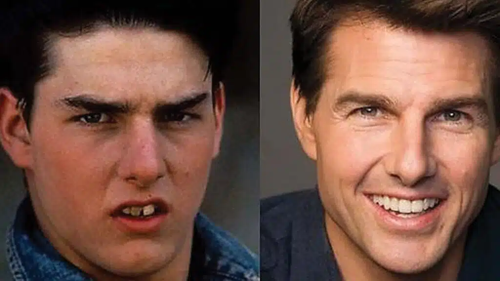 Los Mejores Celebridades que Tienen Sonrisa de Hollywood 5 DENTAL8