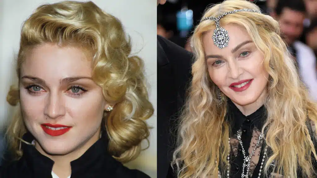 Los Mejores Celebridades que Tienen Sonrisa de Hollywood 6 Dental