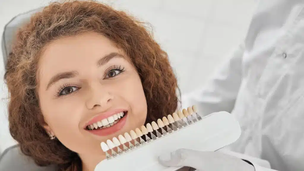 Los Mejores Celebridades que Tienen Sonrisa de Hollywood 8 Dental3