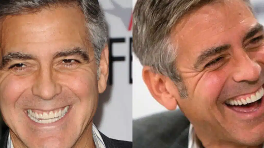 Los Mejores Celebridades que Tienen Sonrisa de Hollywood 3 Dental7