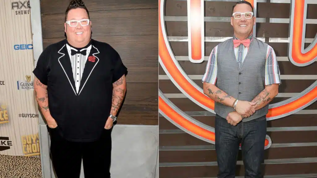 Graham Elliot Weight Loss Surgery 1 1 1
