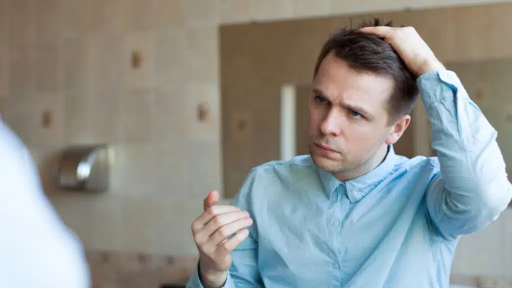 Common Post-Hair Transplant Issues: Is It Normal to Have? 1 2 1