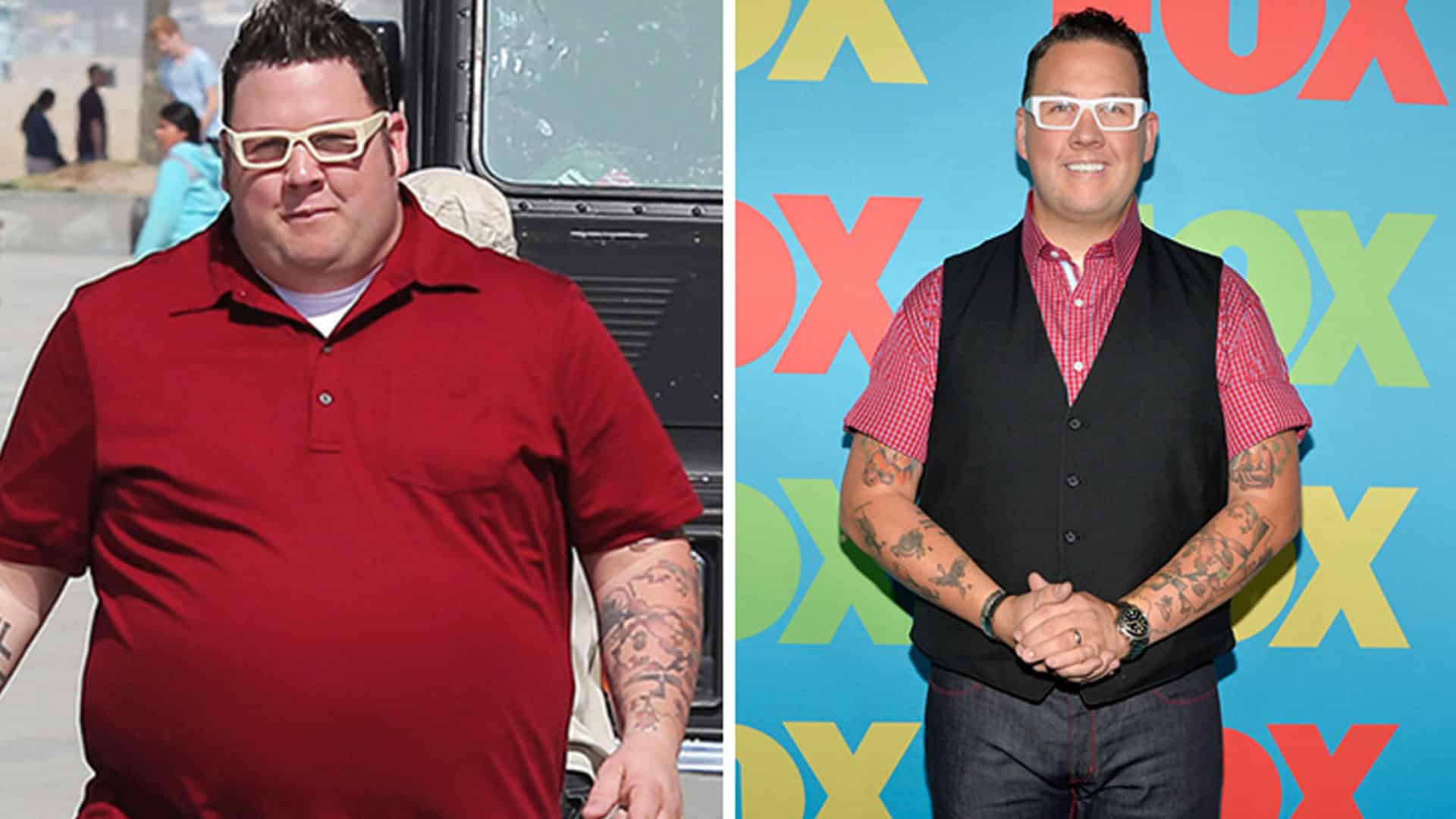 Graham Elliot Weight Loss Surgery