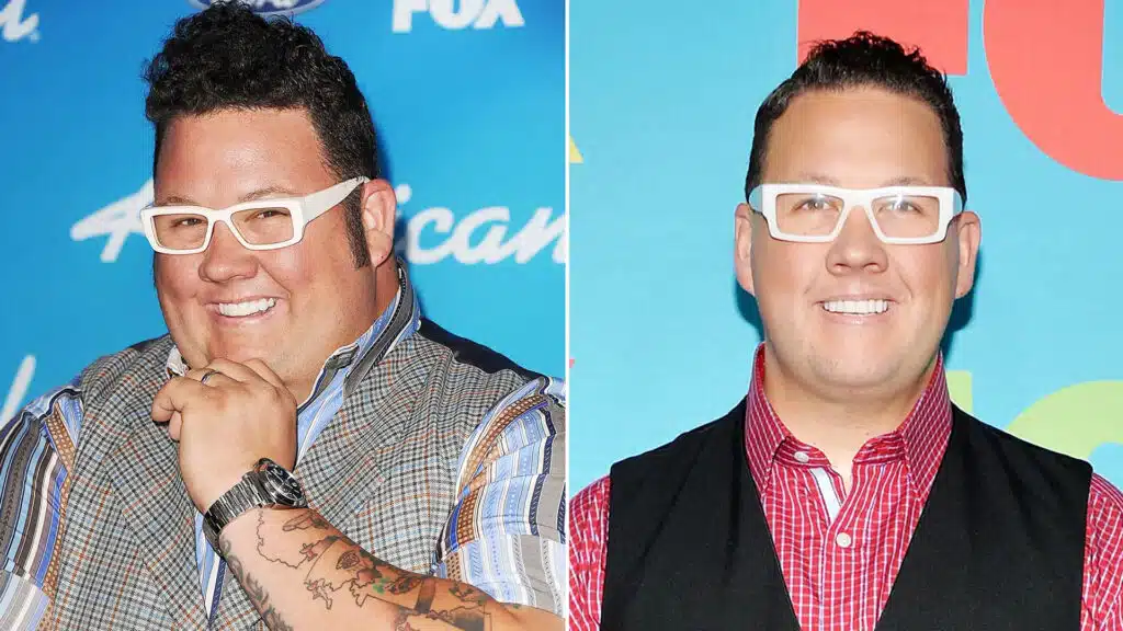 Graham Elliot Weight Loss Surgery 2 3