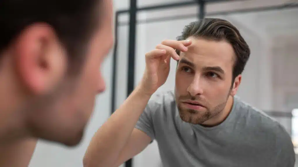 Common Post-Hair Transplant Issues: Is It Normal to Have? 5 6