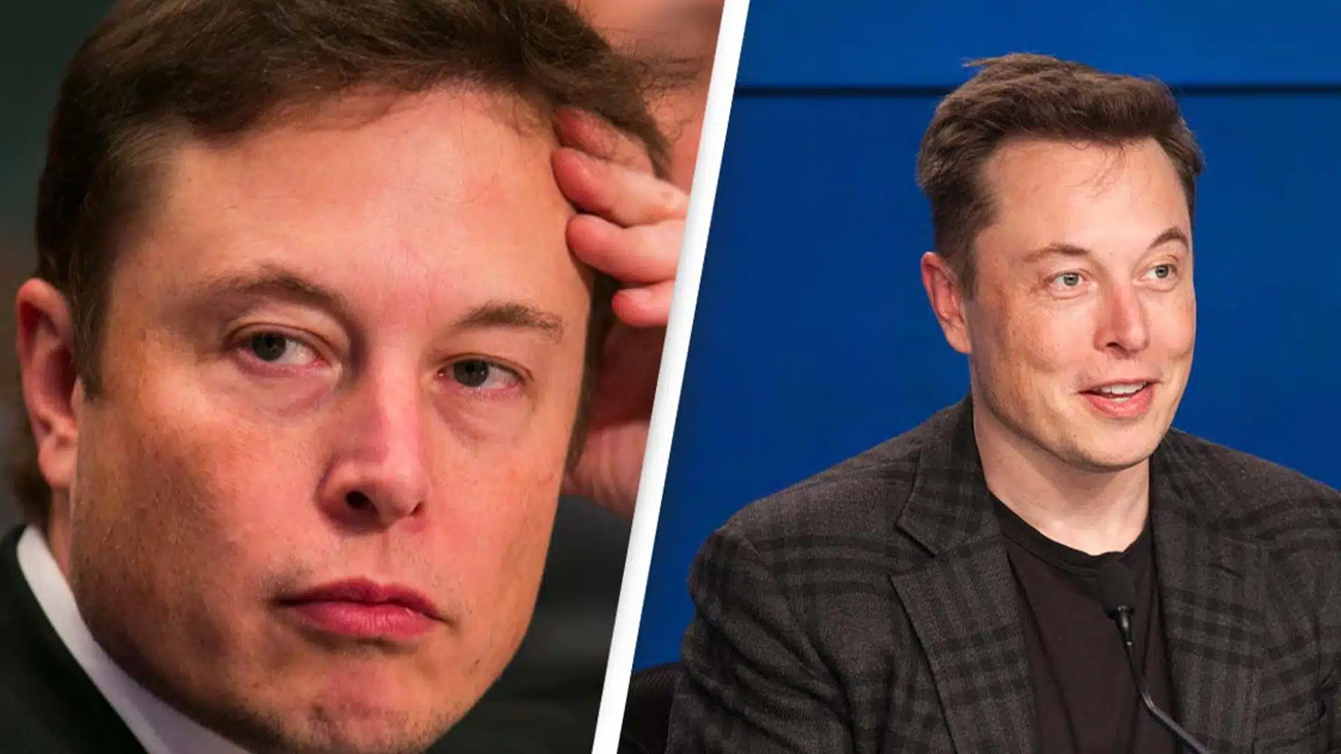 Elon Musk Saç Ektirdi mi? 2 ELON3