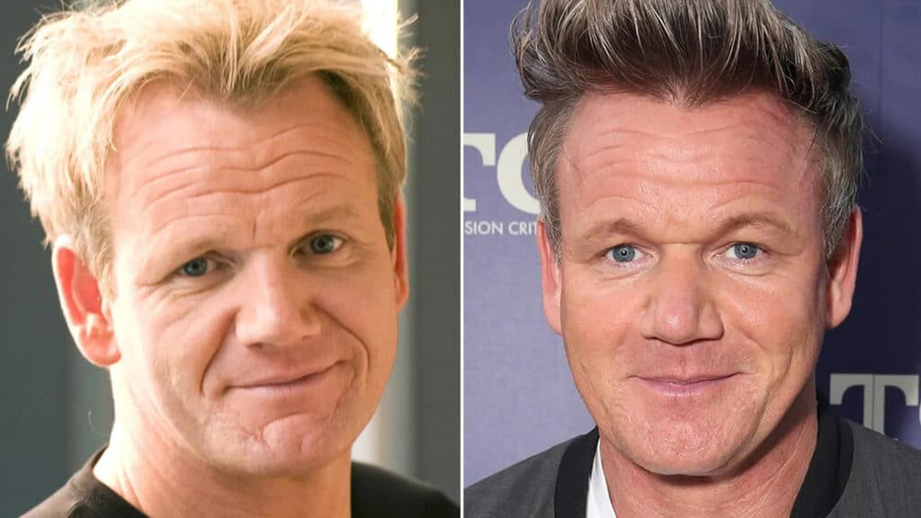 Gordon Ramsay Saç Ekimi 2 gordon ramsey before after 2