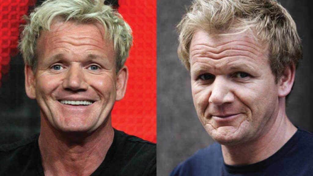 Gordon Ramsay Saç Ekimi 1 gordon ramsey before after 3