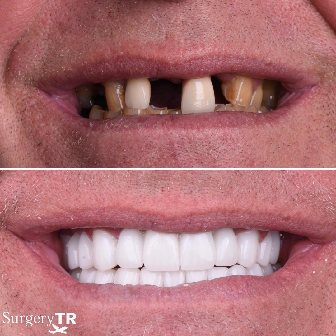 Dental Before After 1