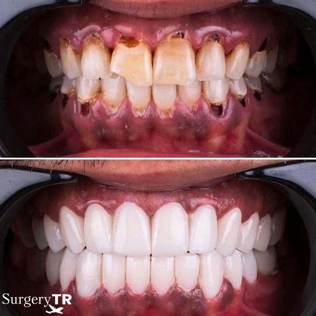 Dental Before After 11