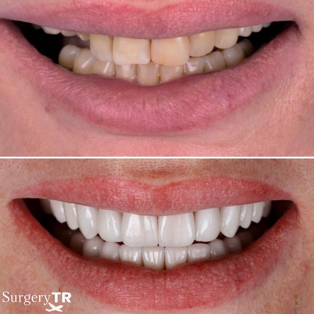 Dental Before After 12
