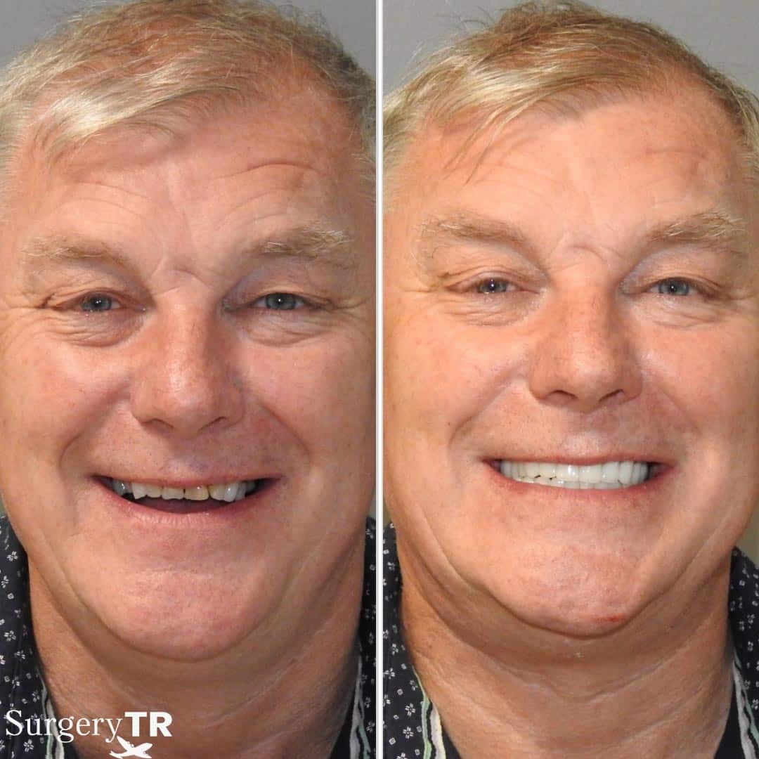 Dental Before After 2