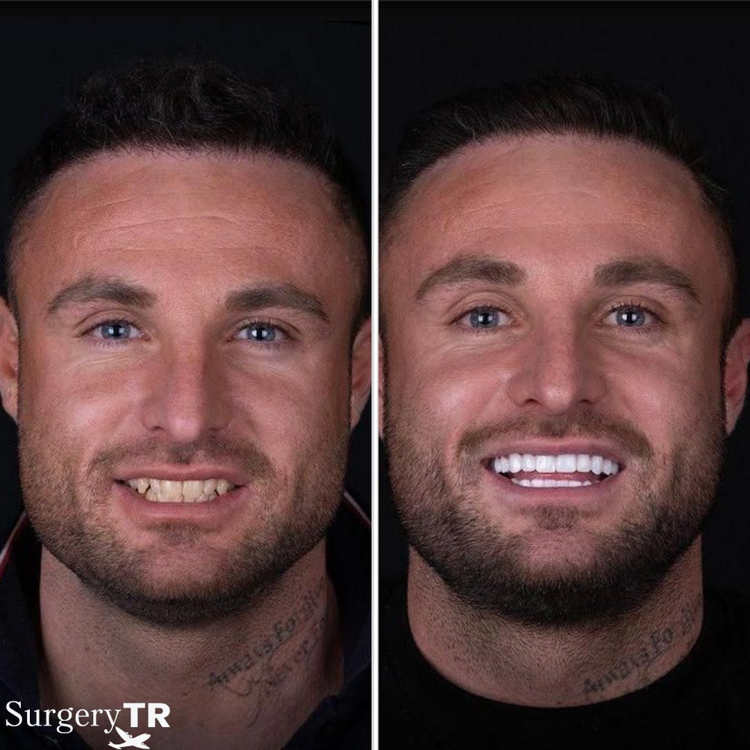 Dental Before After 4
