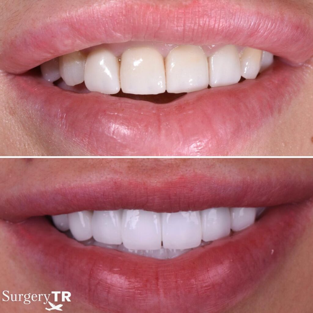 Dental Before After 6