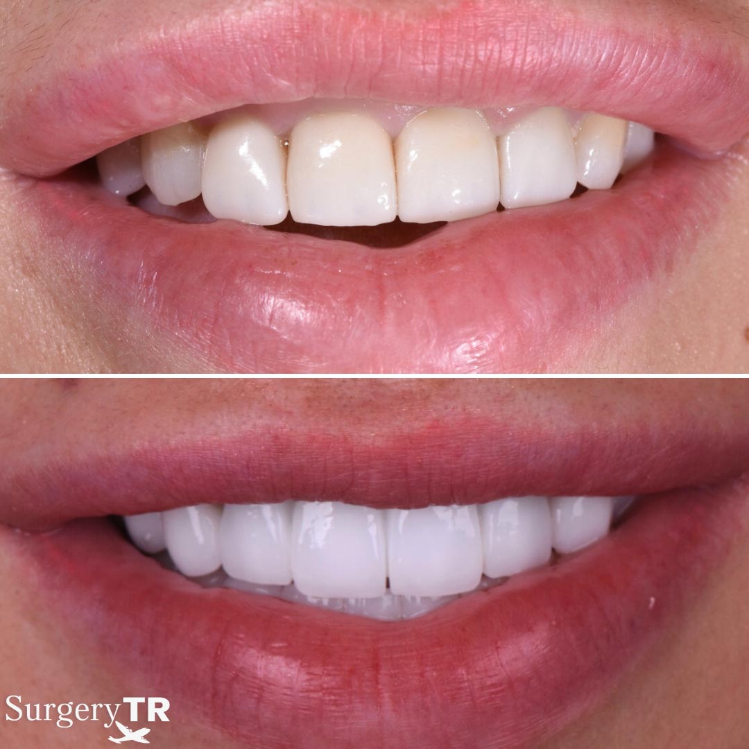 Dental Before After 6