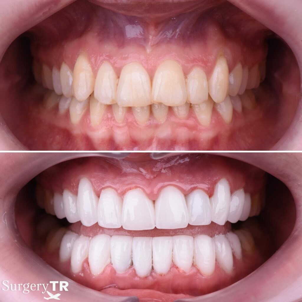 Dental Before After 7