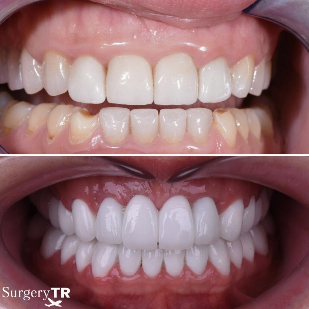 Dental Before After 9