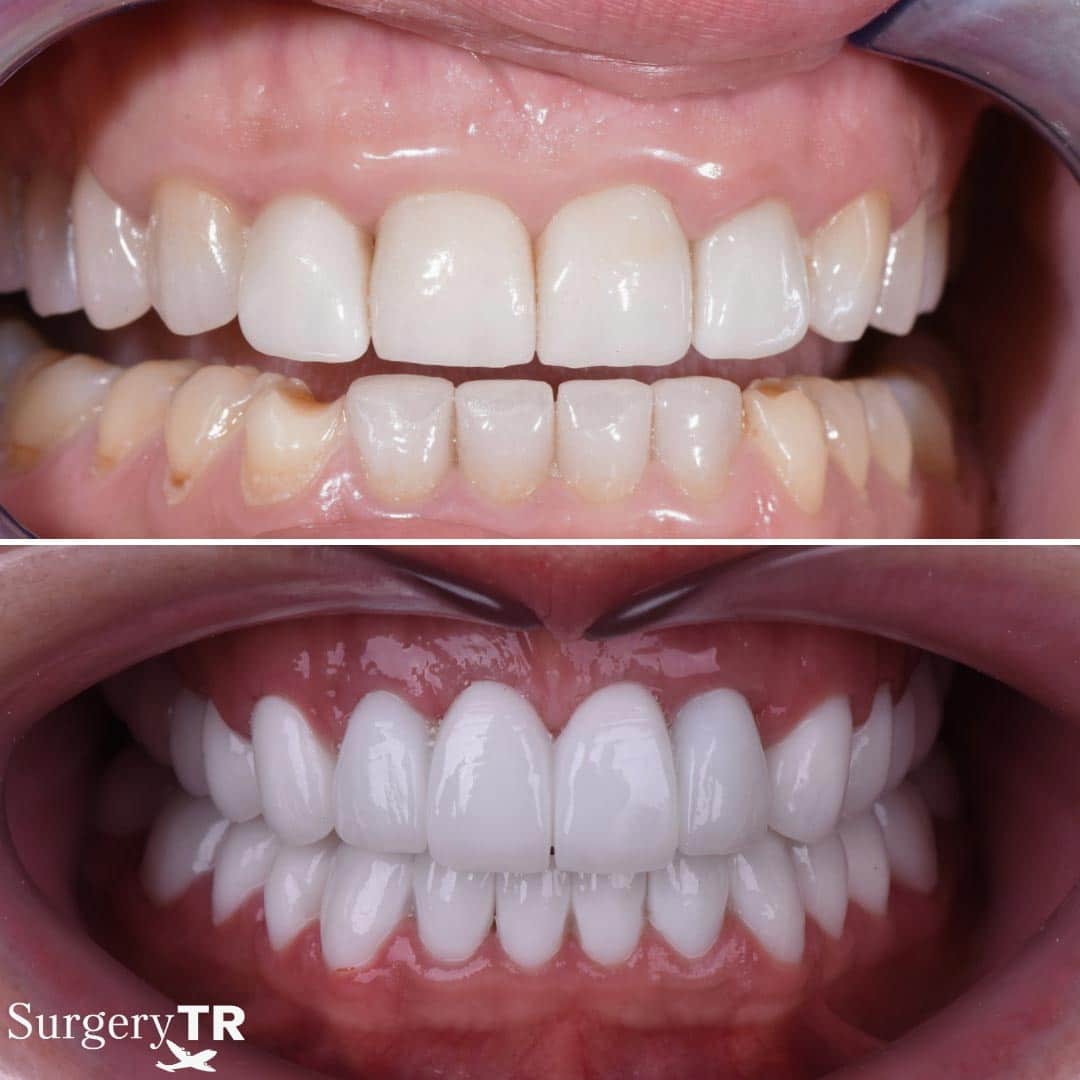Dental Before After 9
