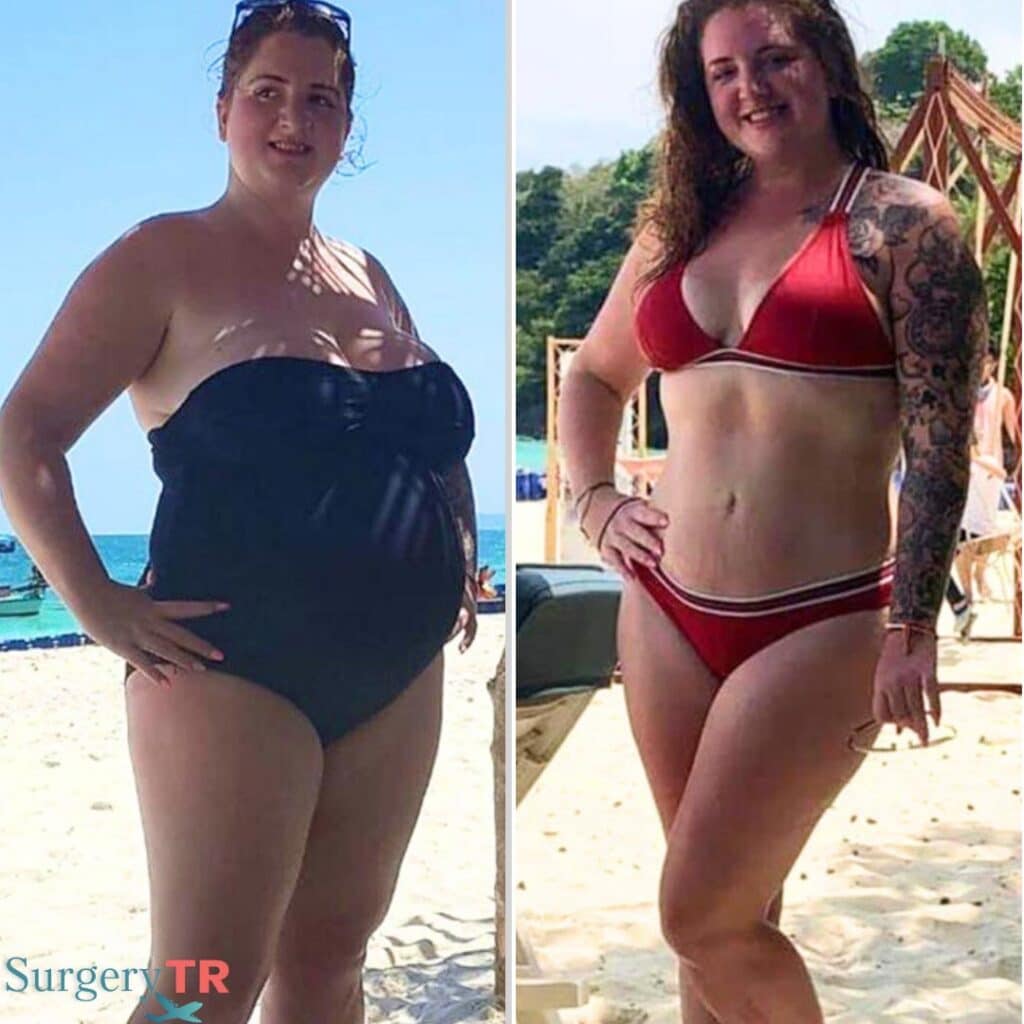 Weight Loss Before After 1