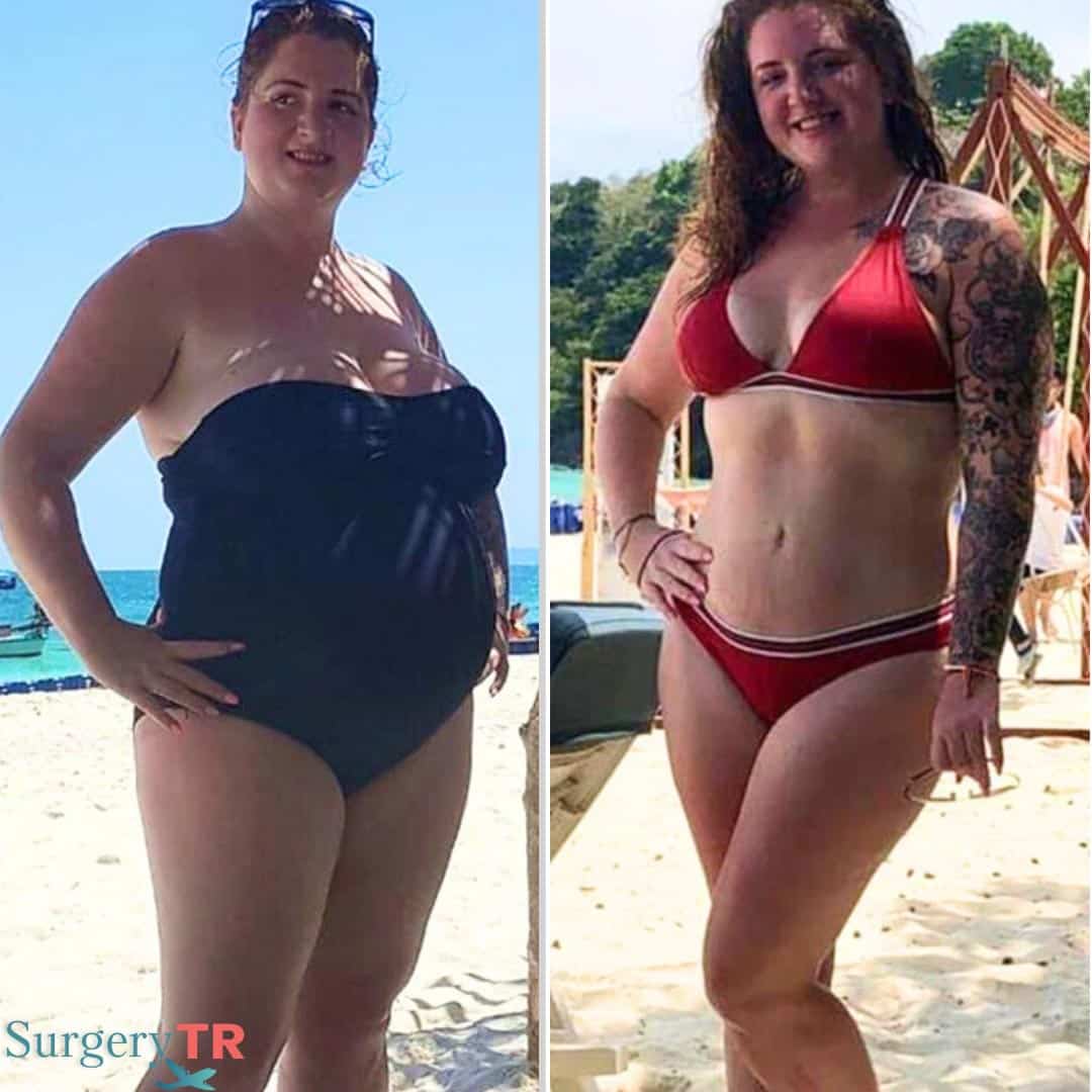 Weight Loss Before After 1