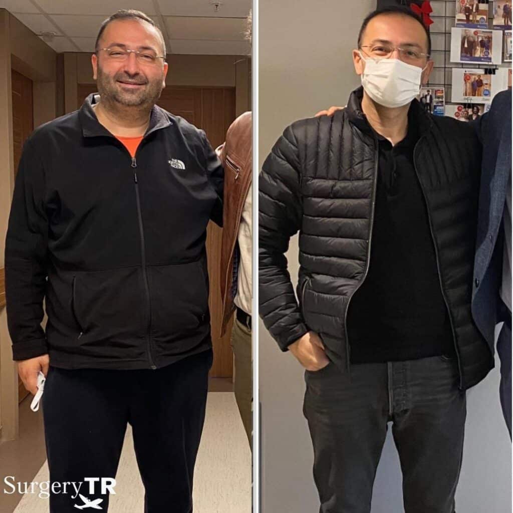Weight Loss Before After 2