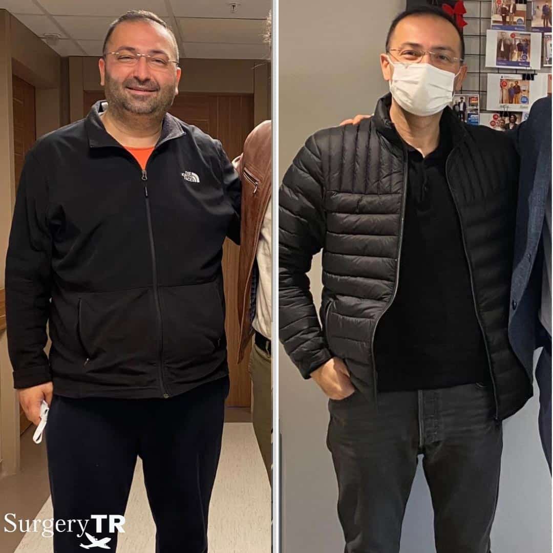 Weight Loss Before After 2