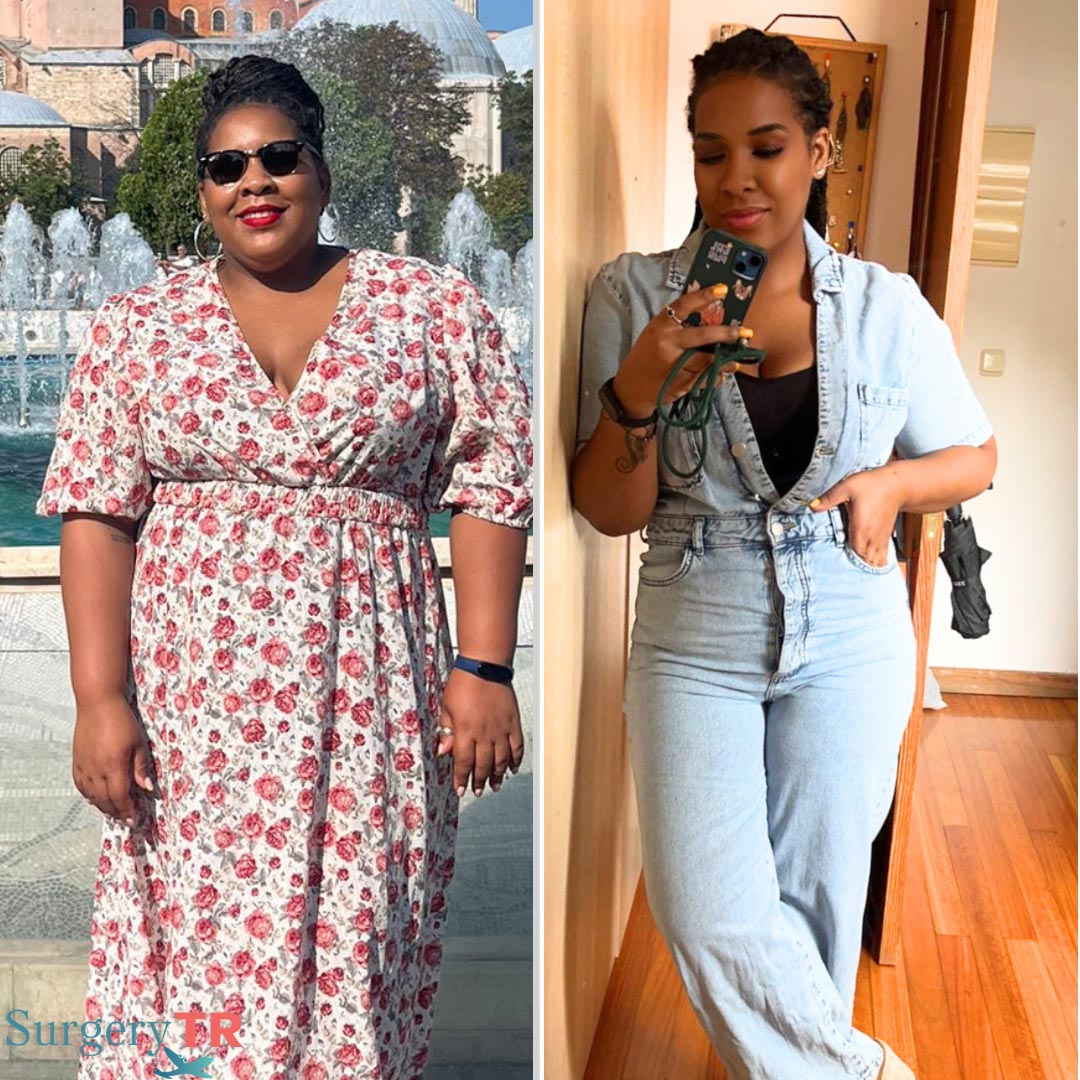 Weight Loss Before After 3