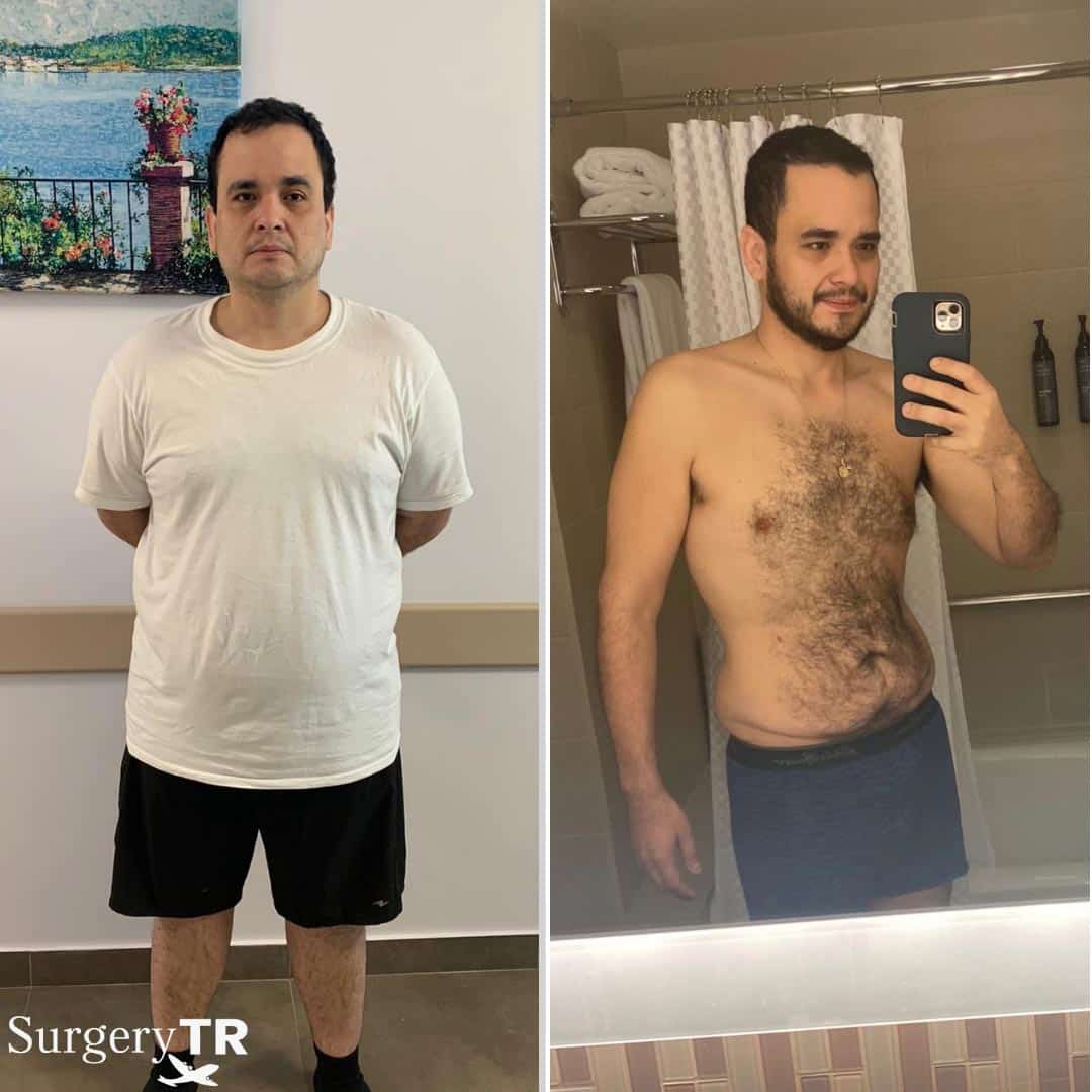 Weight Loss Before After 4