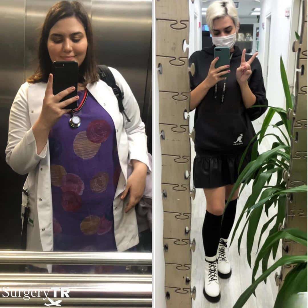 Weight Loss Before After 7