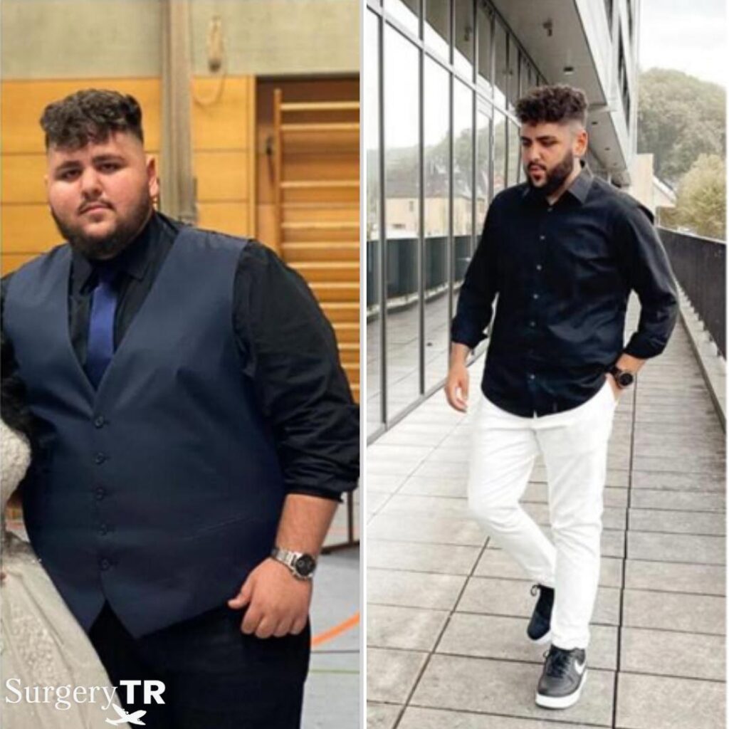Weight Loss Before After 8