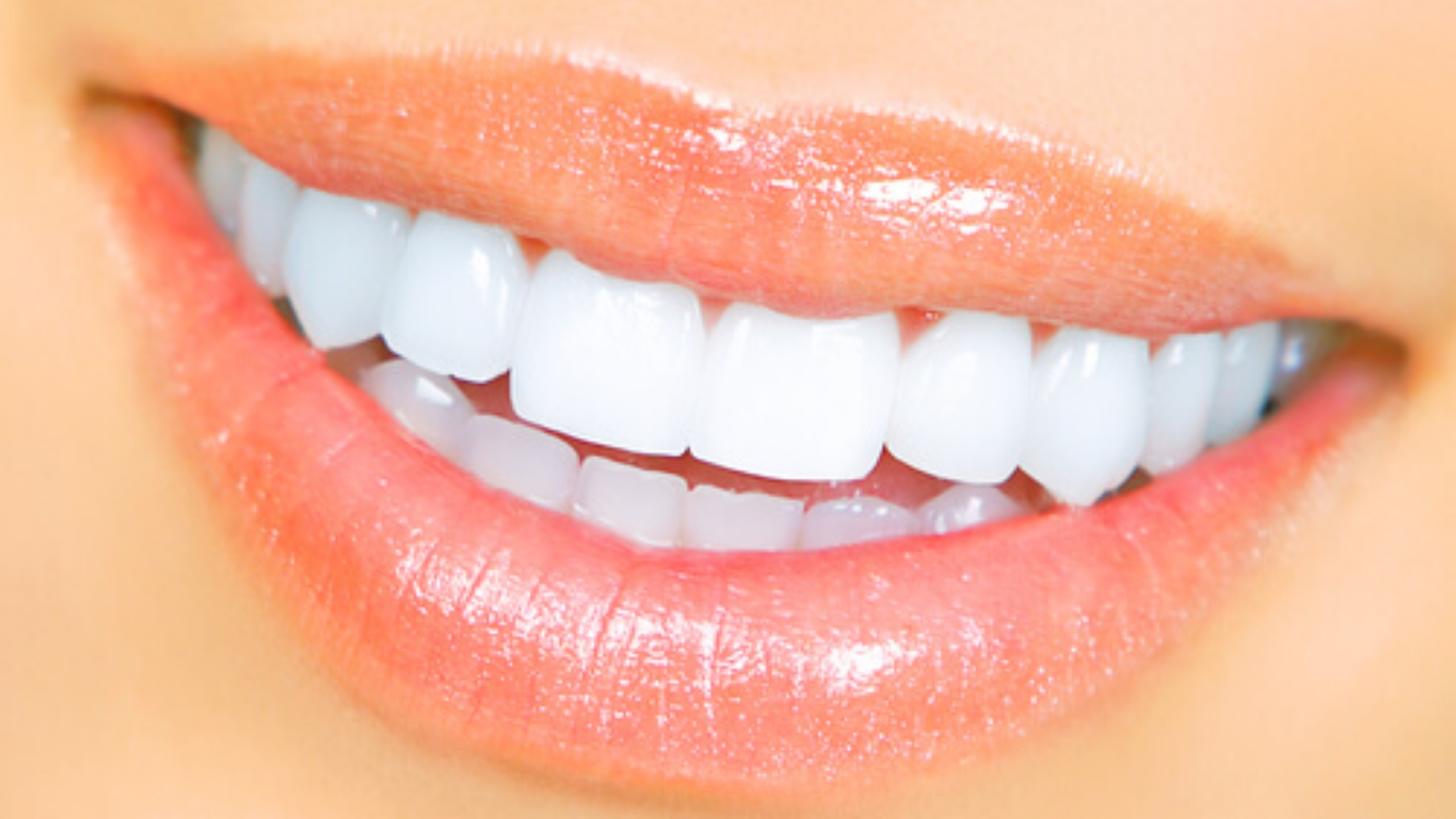 What Exactly Is the Hollywood Smile? Everything You Need to Know