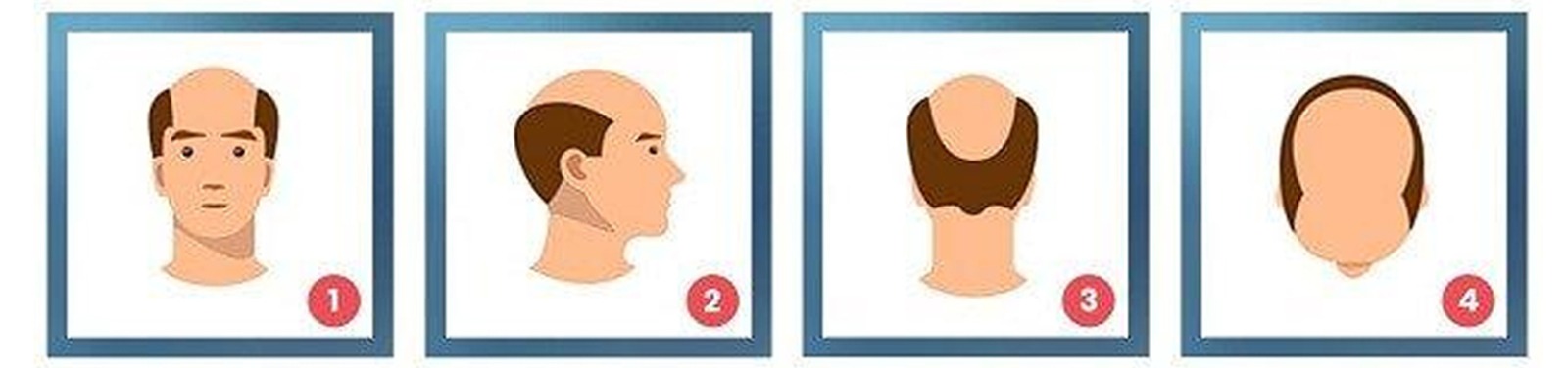 65bab592 87e3 4a79 91fa c87924c521ff