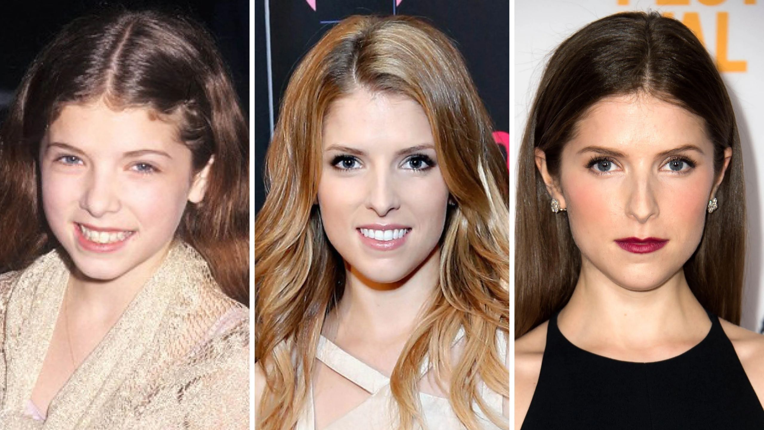 Anna Kendrick Plastic Surgery