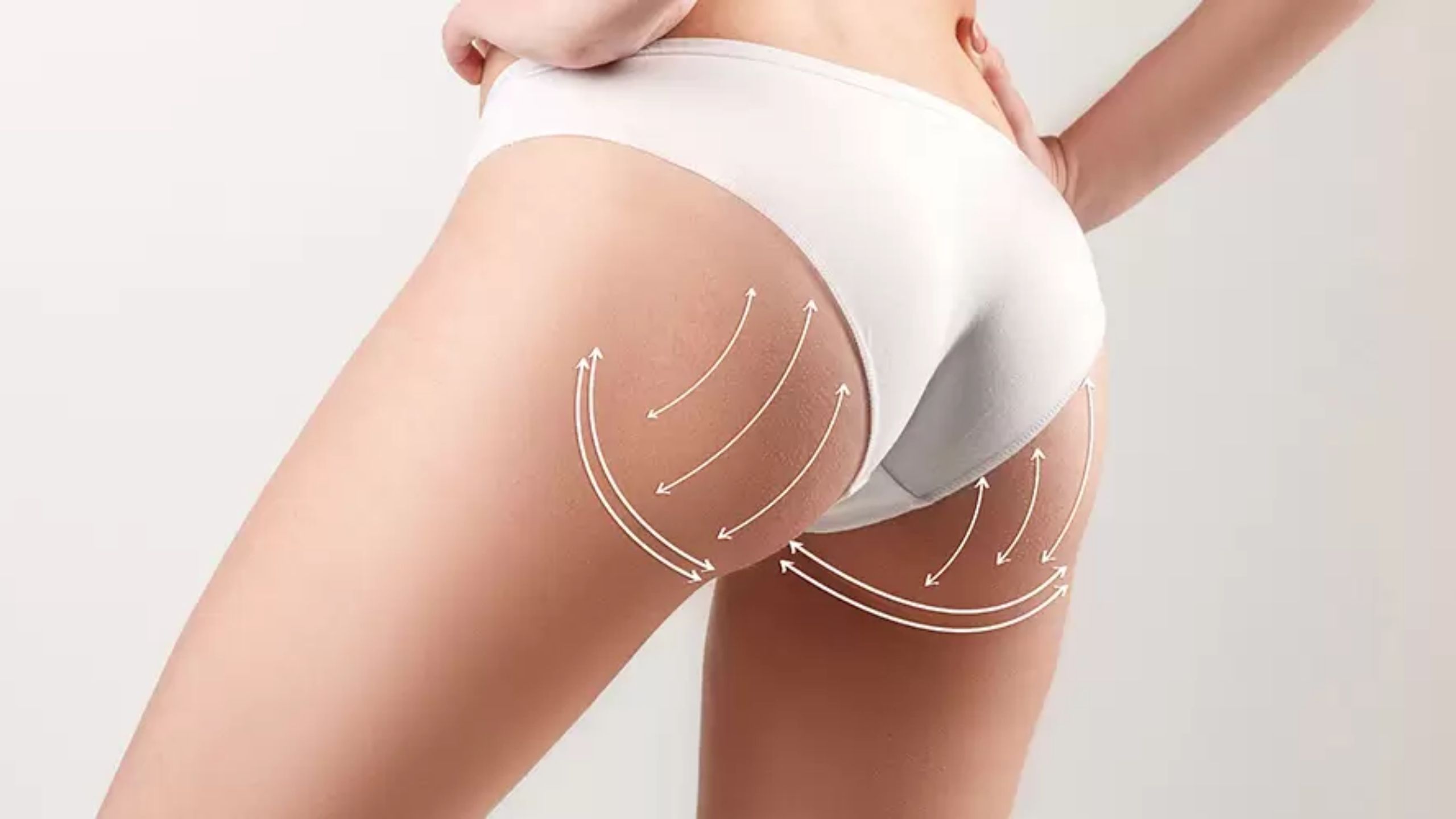 10 Things You Need to Know About Brazilian Butt Lift