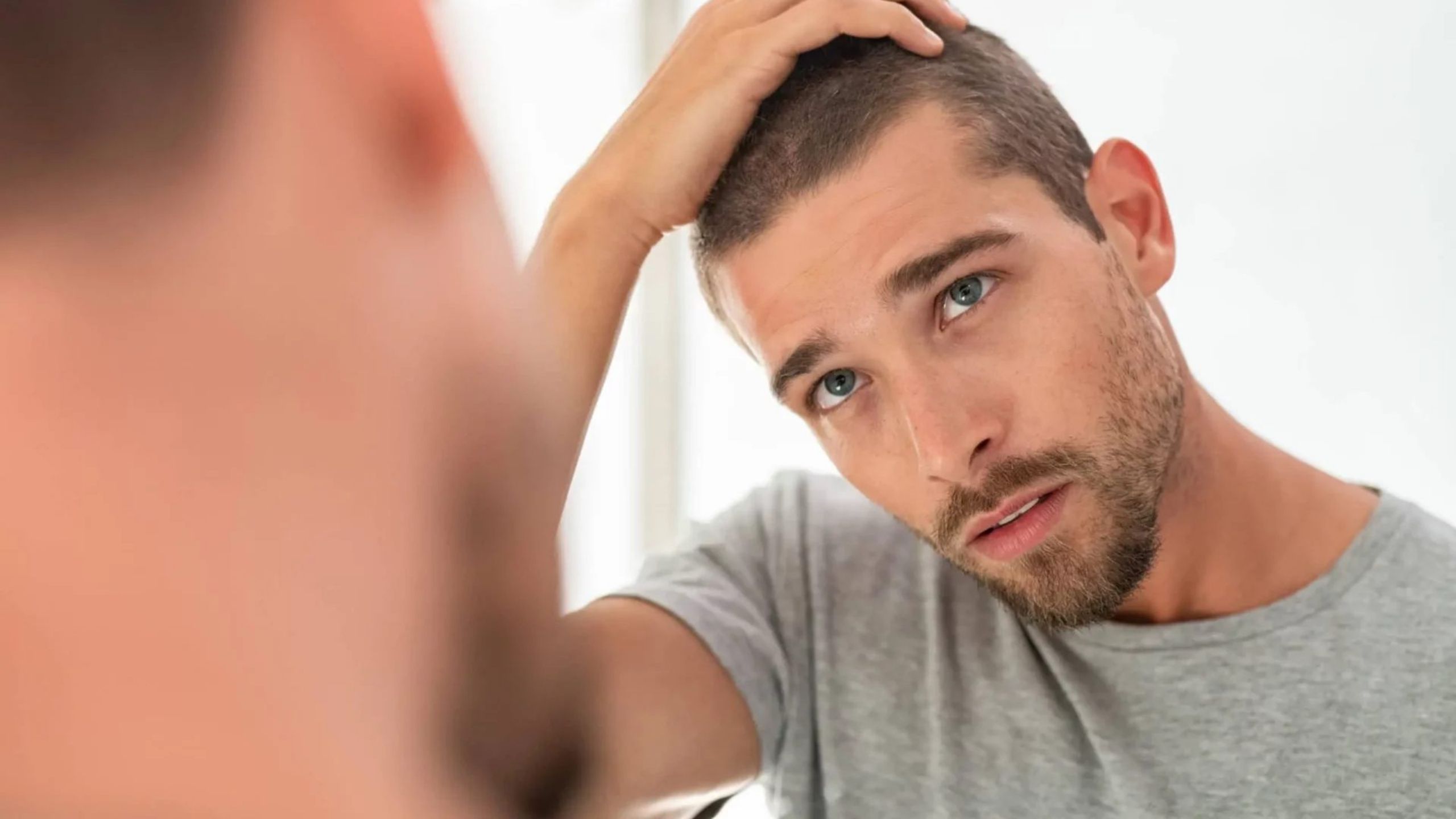 Can You Dye Your Hair Before or After Hair Transplant?