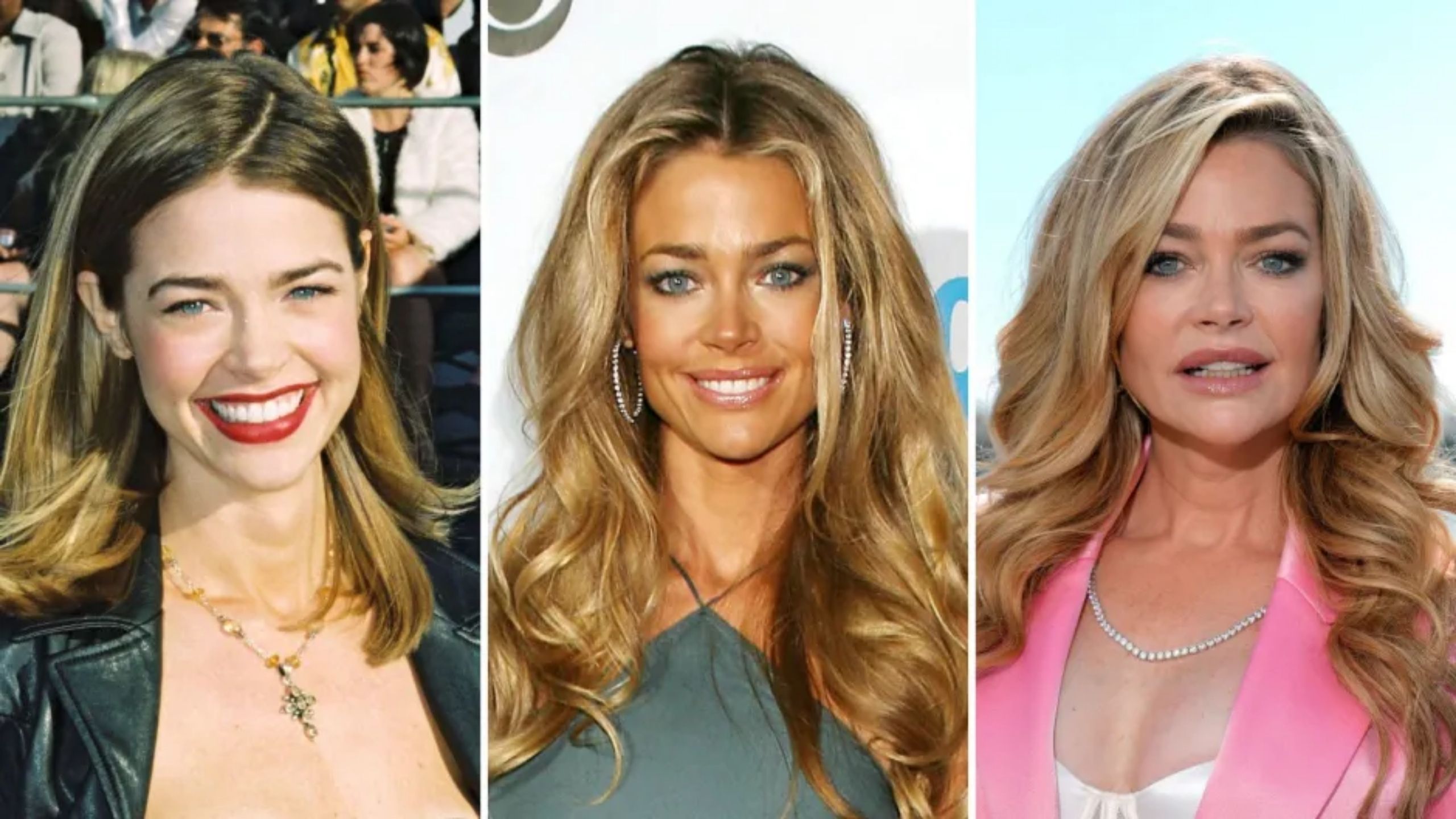Denise Richards Plastic Surgery