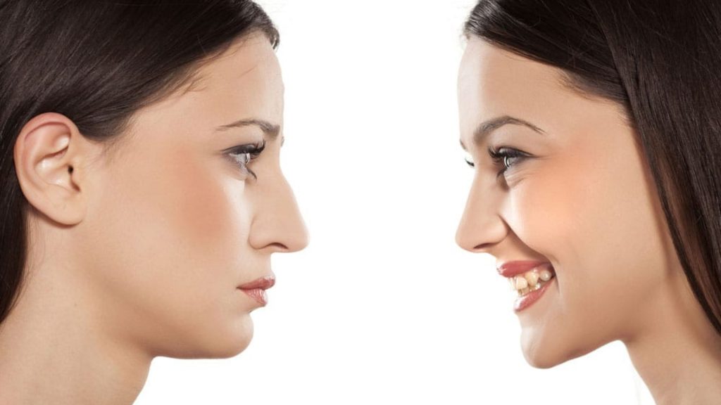Is Rhinoplasty Only About Aesthetics? Exploring the Functional Side of Nose Surgery 1 How To Pick A Rhinoplasty Surgeon