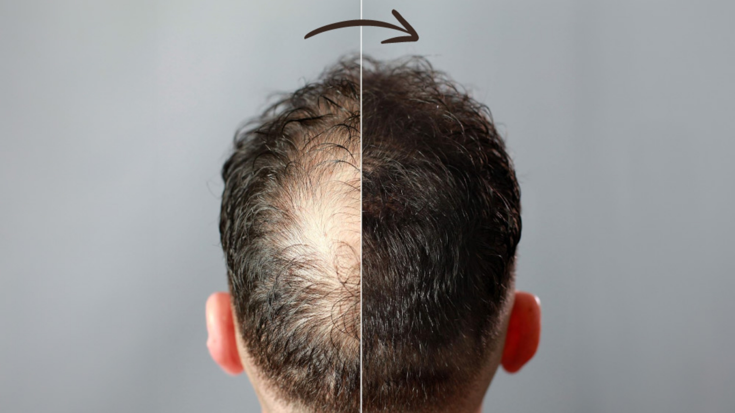 How to Thicken Hair?