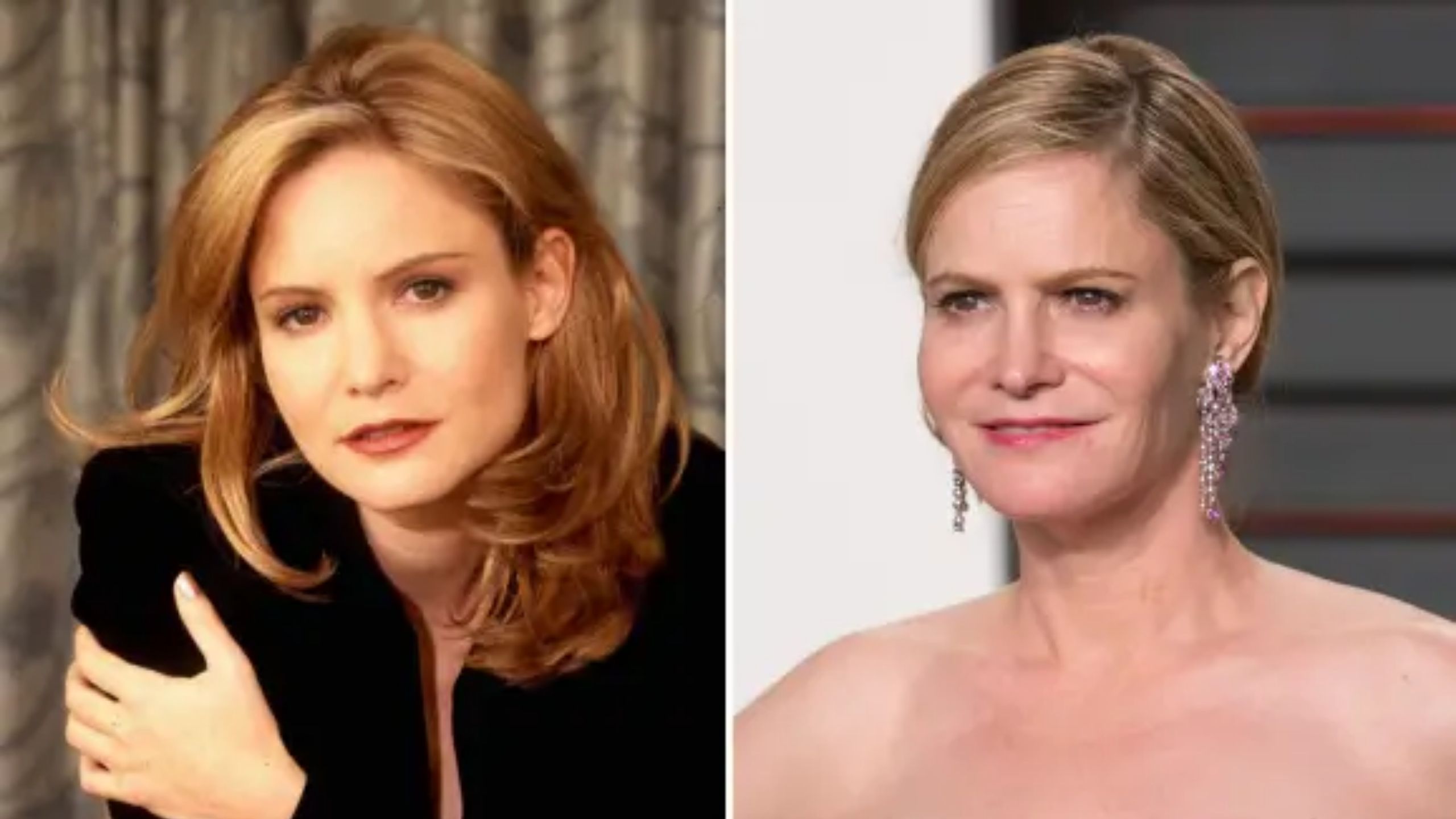 Jennifer Jason Leigh Plastic Surgery