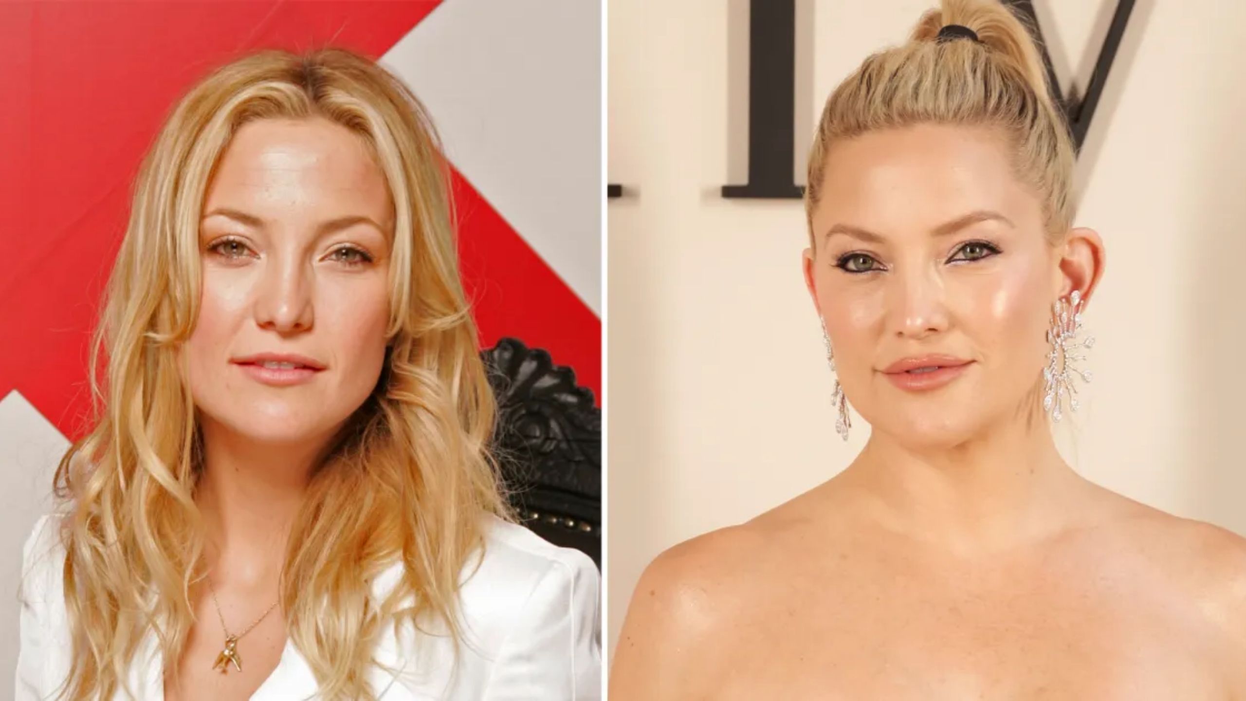 Kate Hudson Plastic Surgery