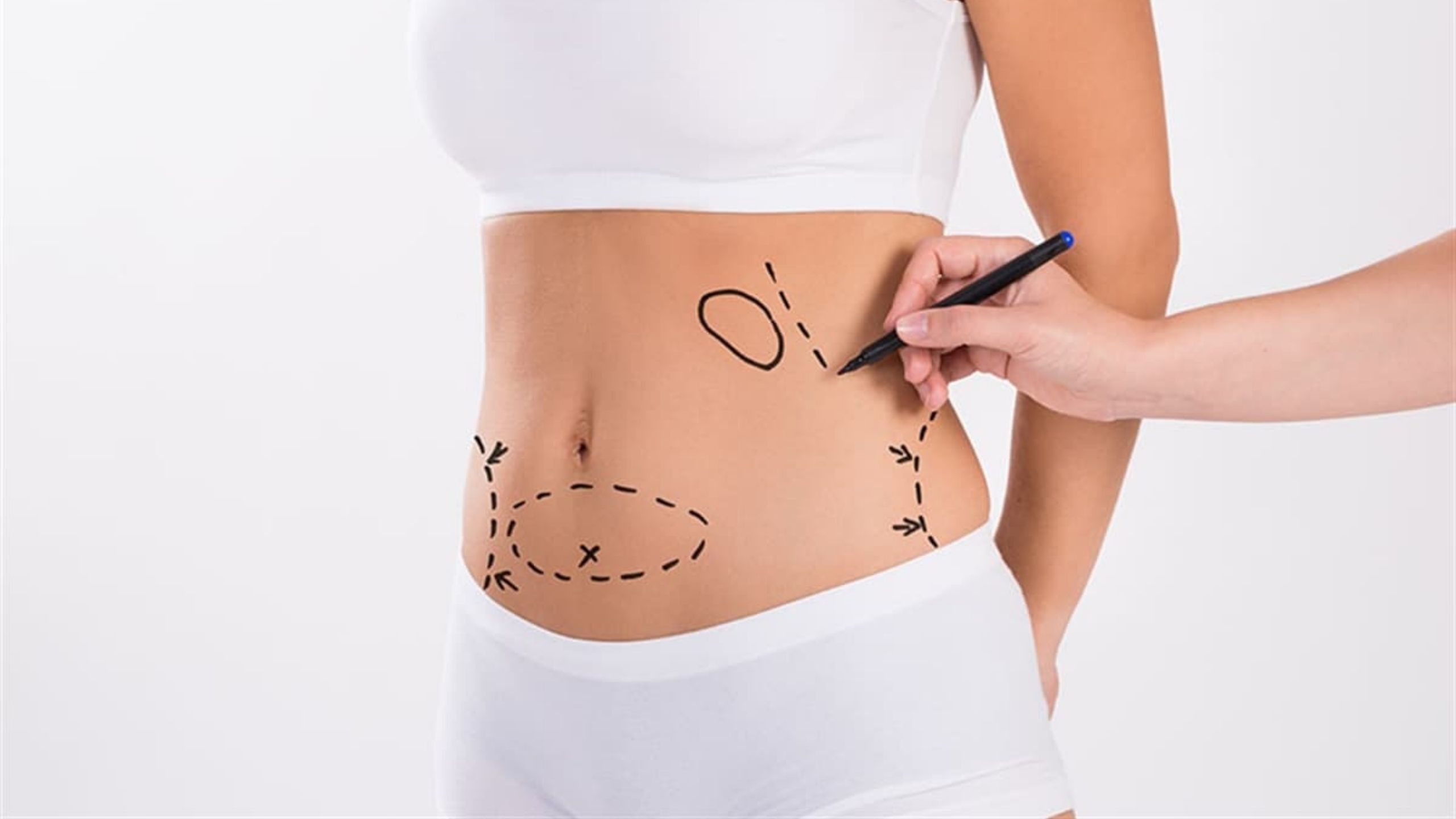 10 Things You Never Heard About Liposuction