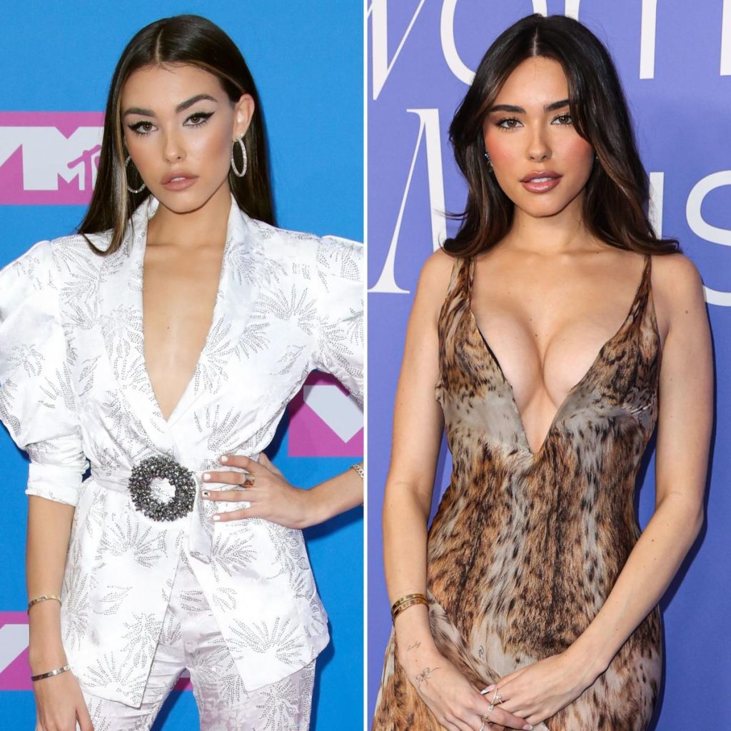 Madison Beer Plastic Surgery - Surgerytr