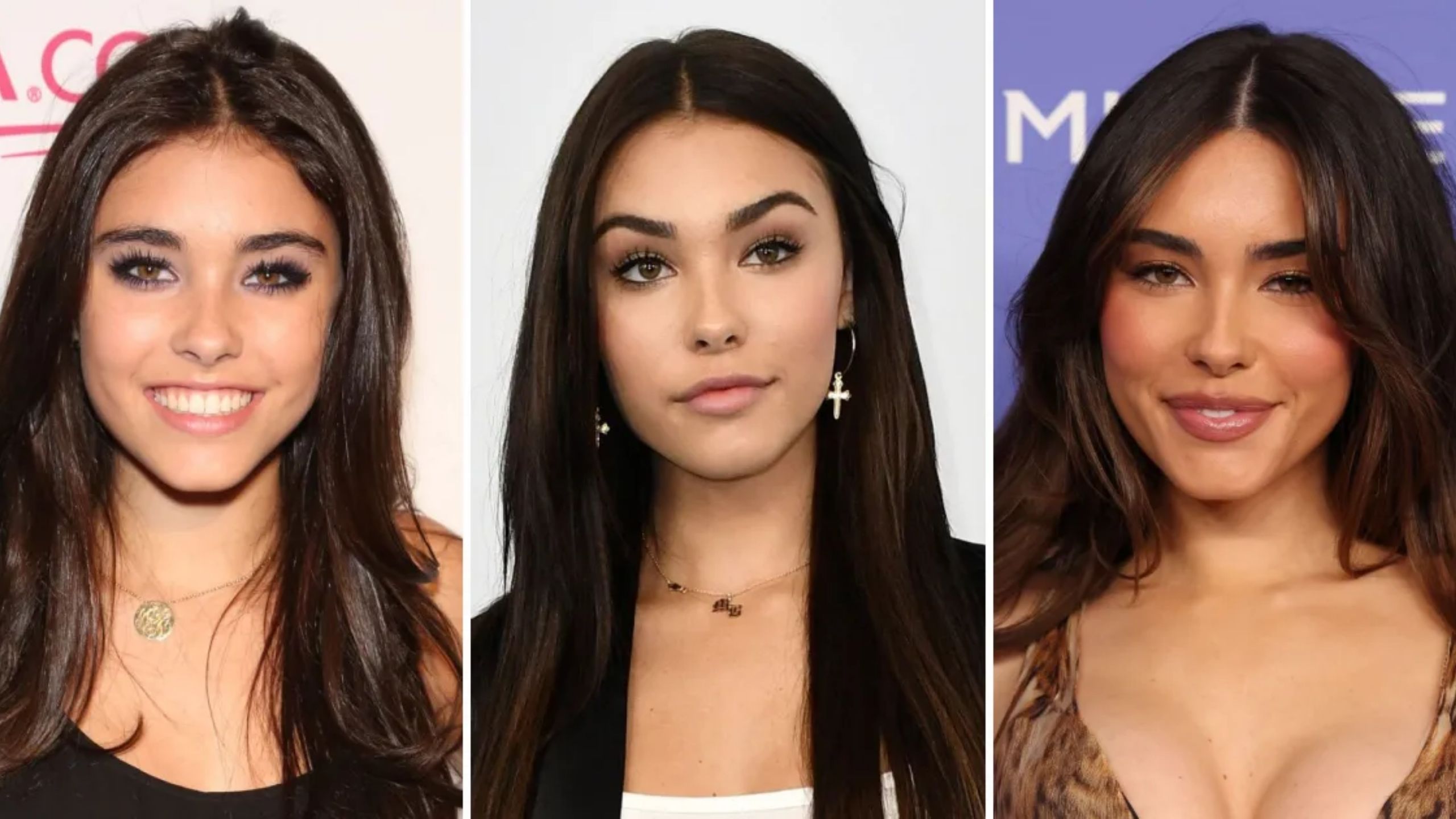 Madison Beer Plastic Surgery - Surgerytr