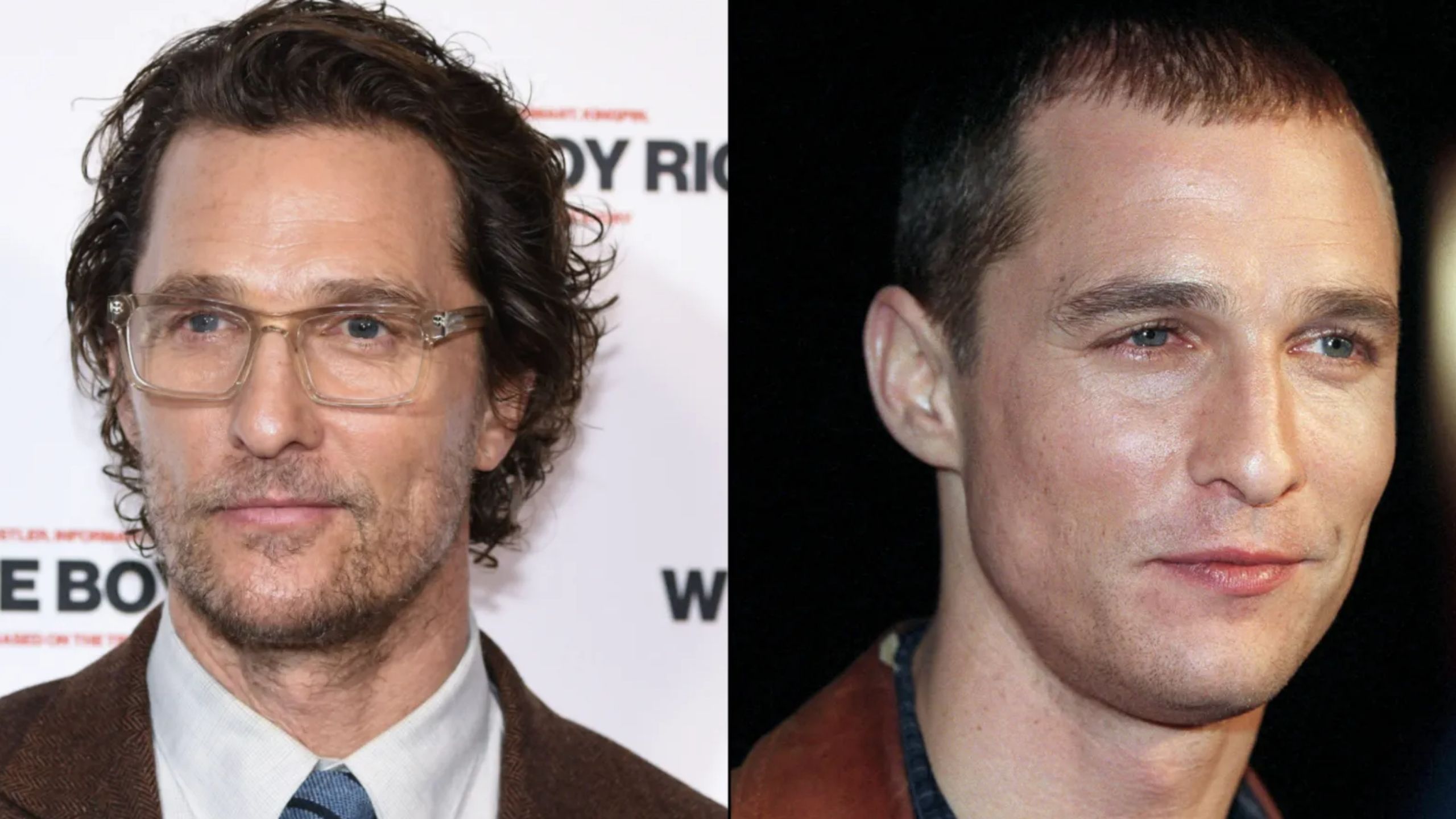 Matthew McConaughey Hair Transplant - Surgerytr