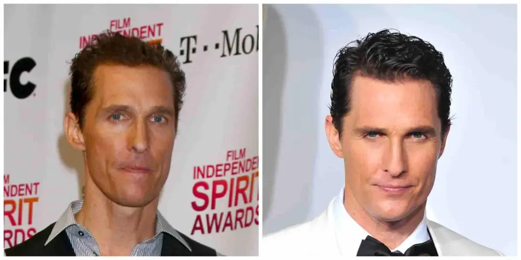 Matthew McConaugheys alleged second hair transplant